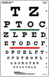Snellen Chart: Manual, Electric